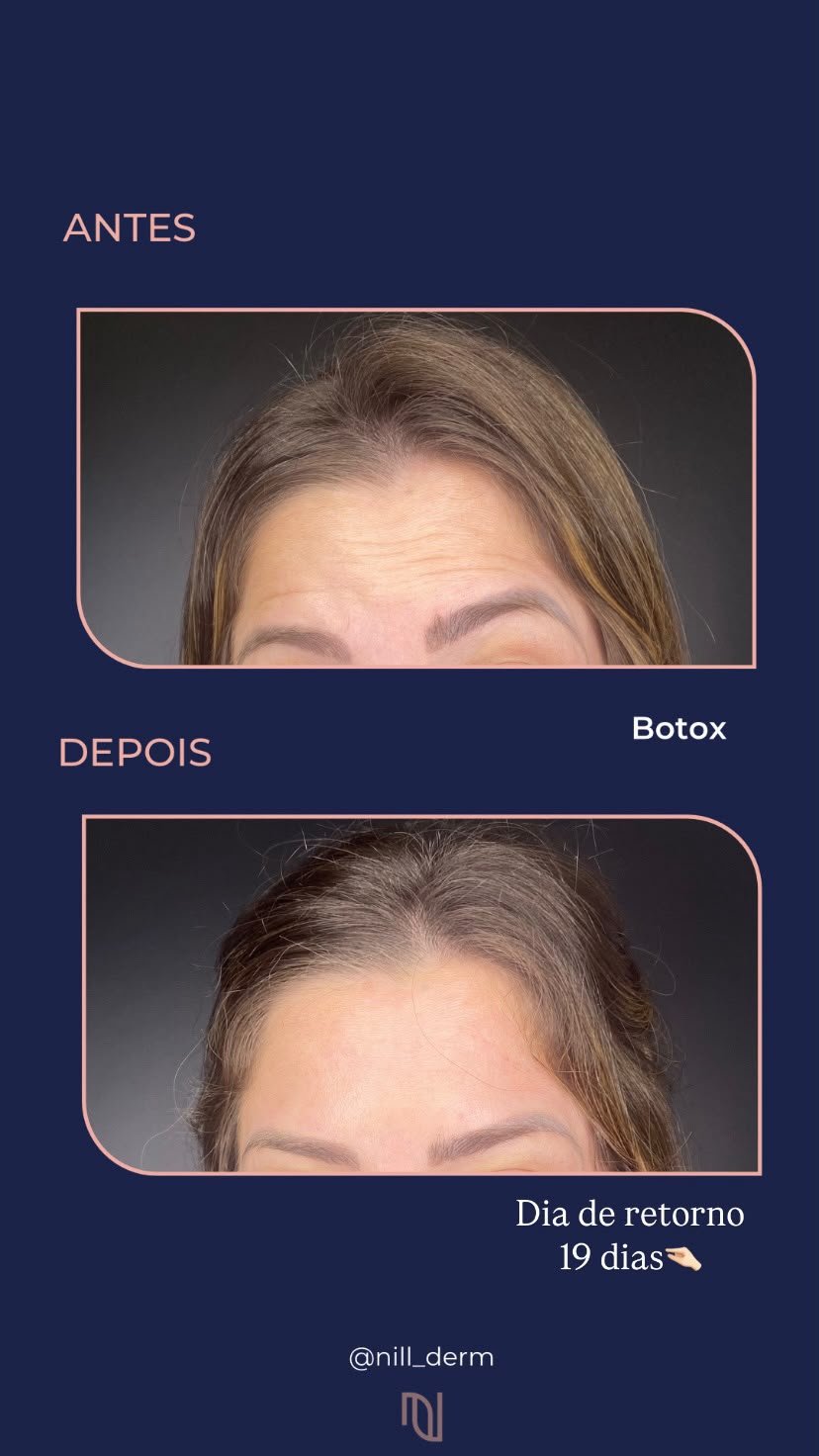 Antes-Depois 2