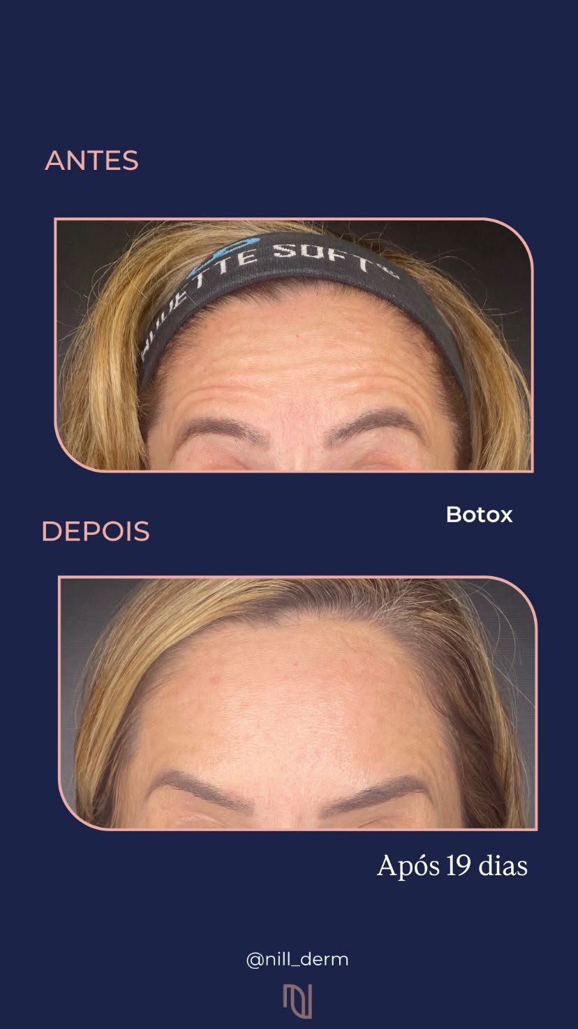 Antes-Depois 3