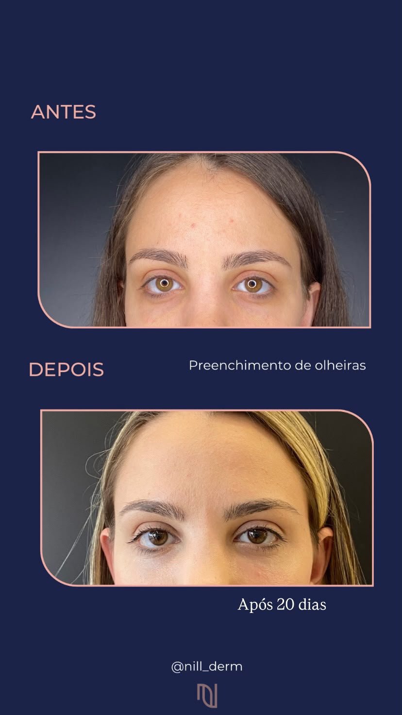 Antes-Depois 4