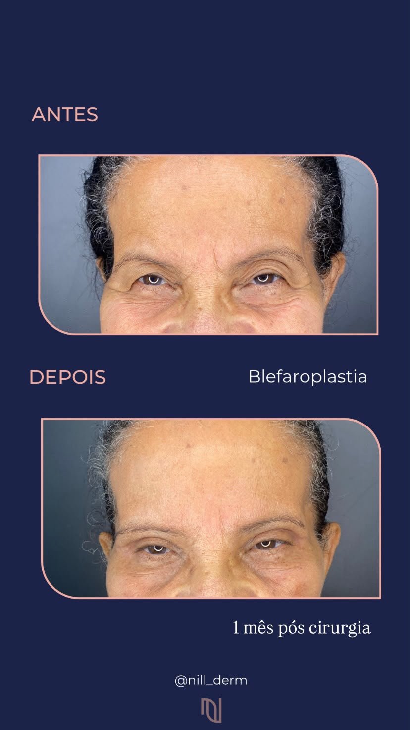 Antes-Depois 5