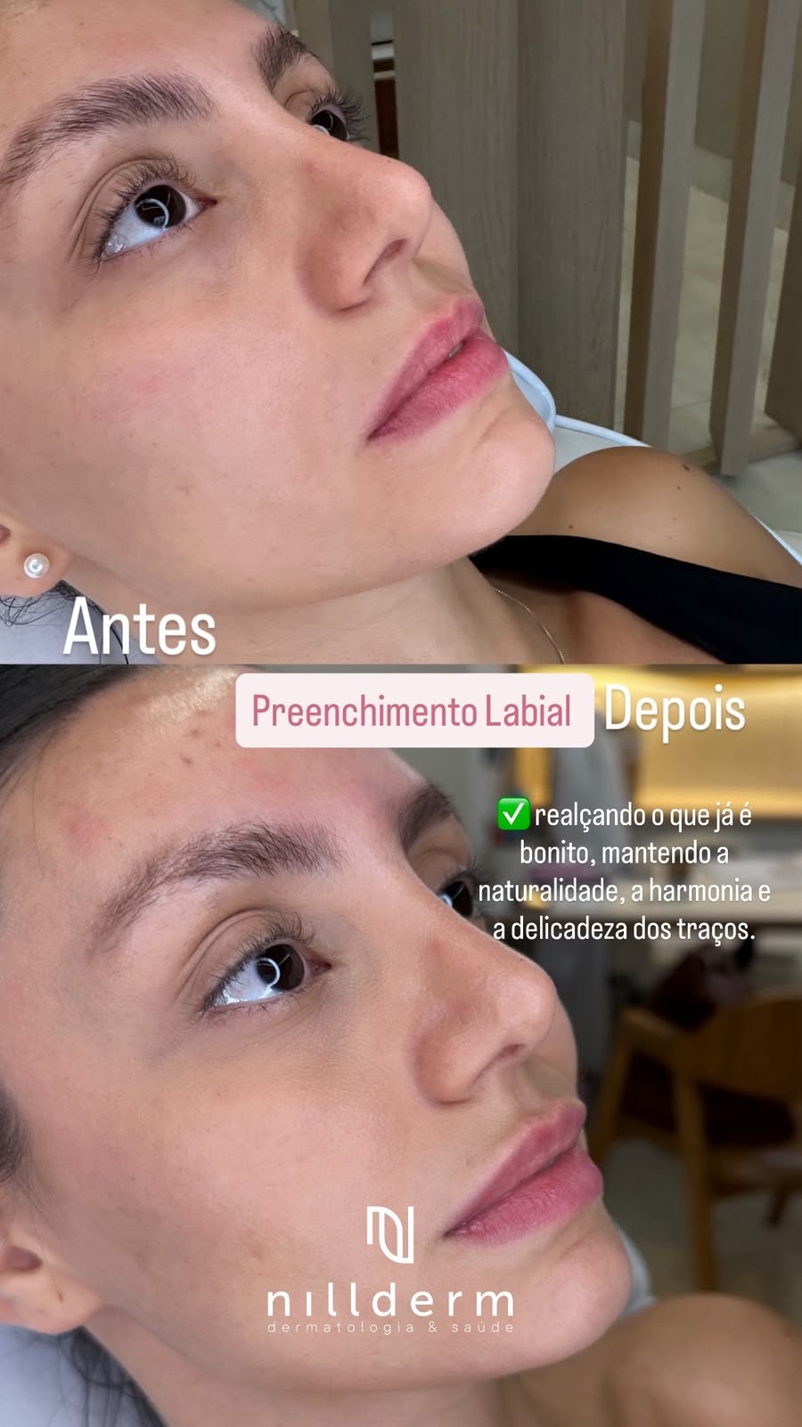 Antes-Depois 7