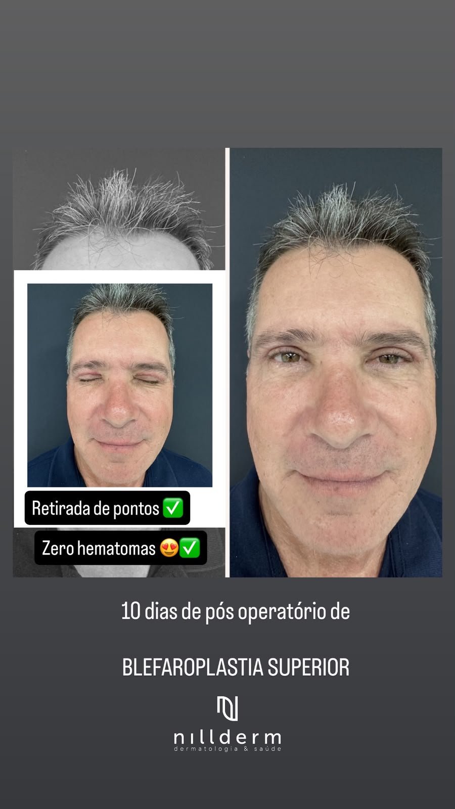 Antes-Depois 8