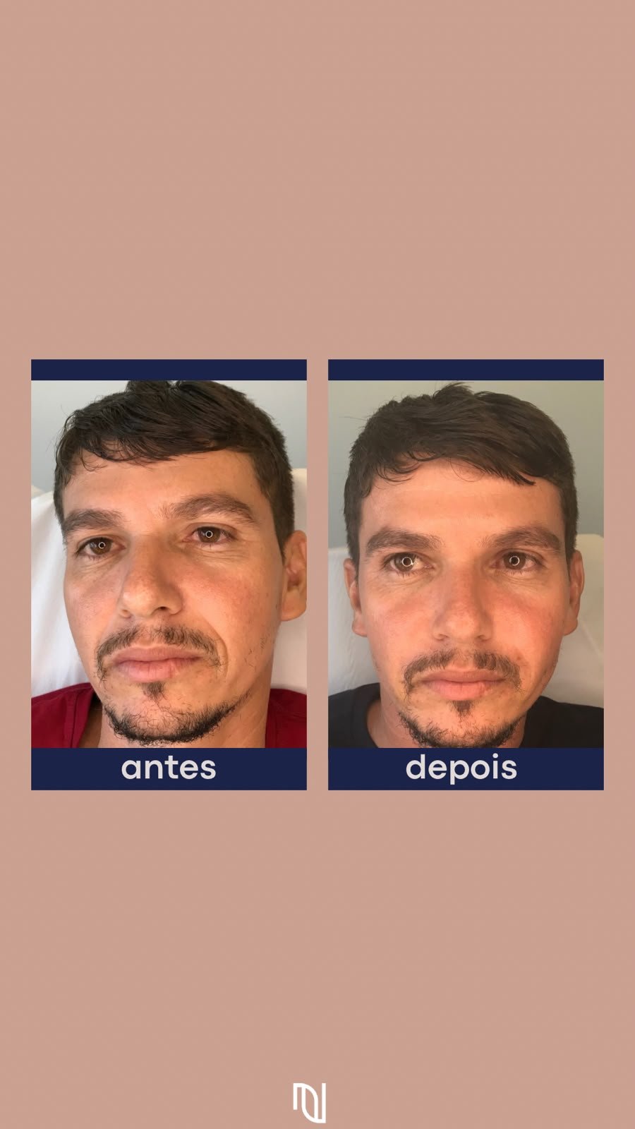 Antes-Depois 9